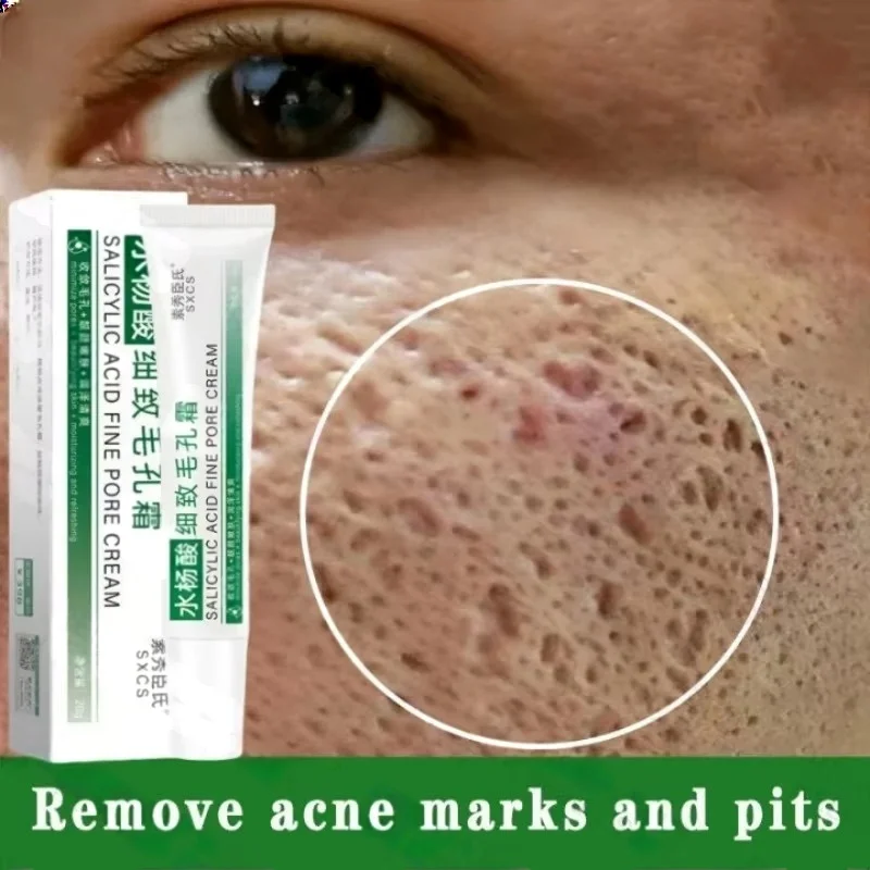 Korean Skincare Routine - Salisilik Asit Gözenek Temizleme Kremi Gözenekleri