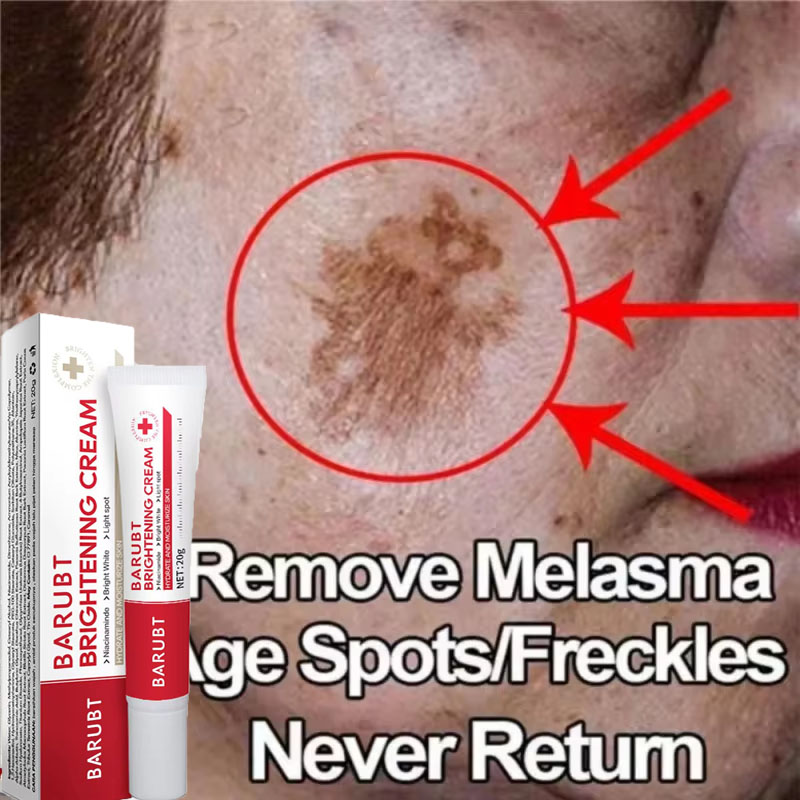 Korean Skincare Routine - Güçlü Leke Giderici Beyazlatıcı Krem Cildi