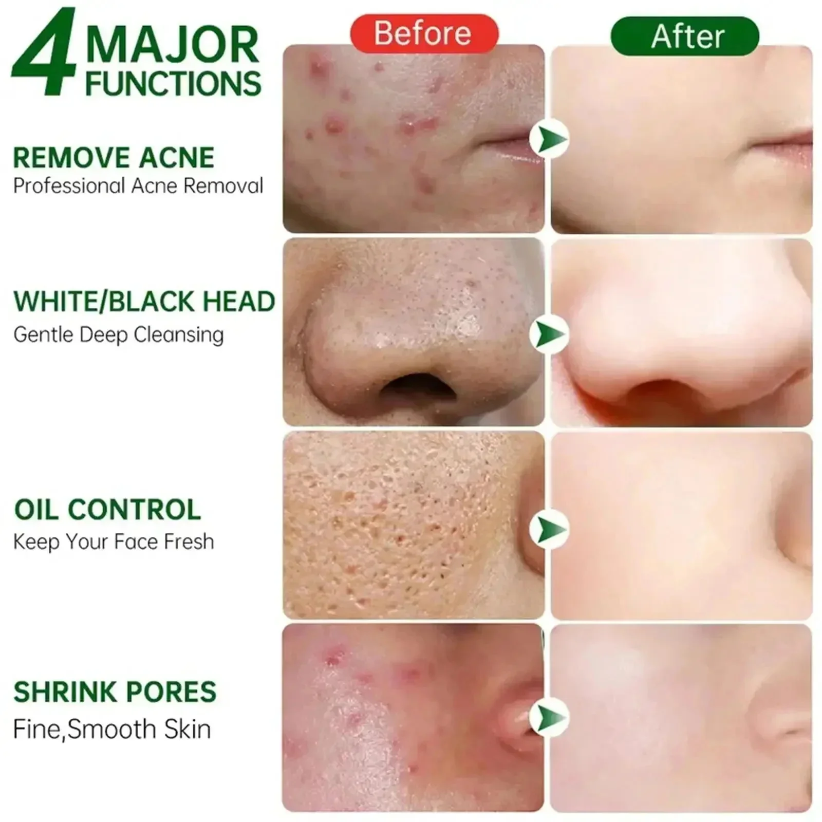 Salisilik Asit Gözenek Temizle - Korean Skincare Routine incelemesi ve fiyatı