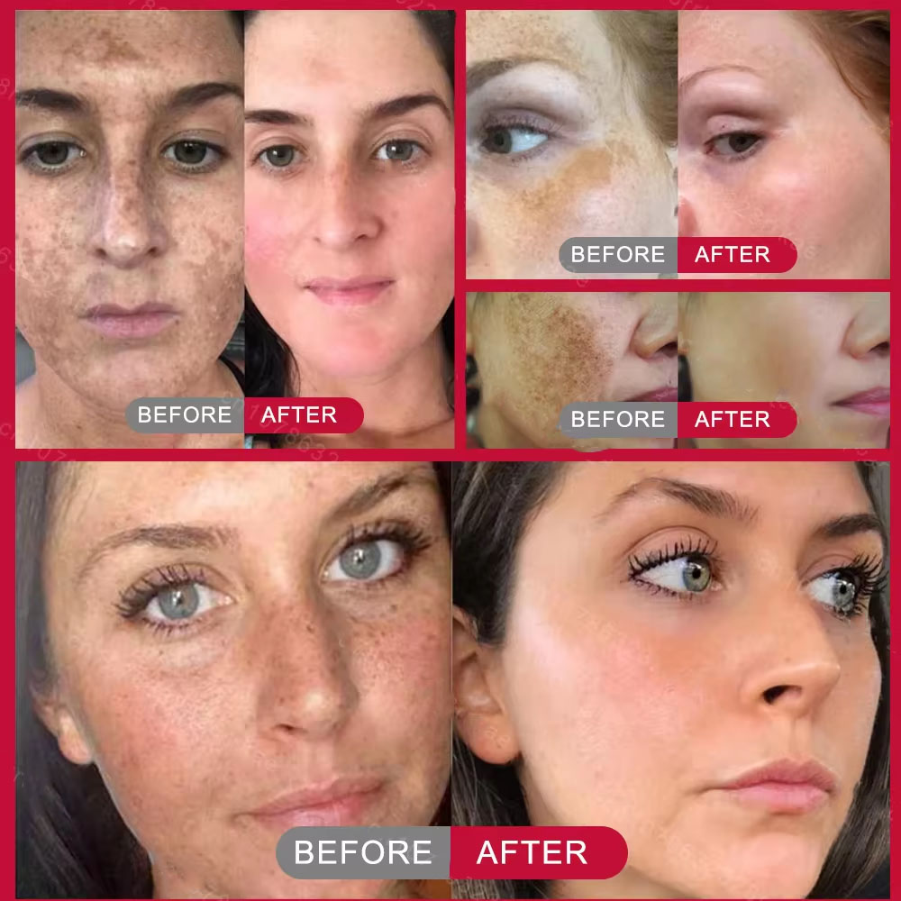 Güçlü Leke Giderici Beyazlatıc - Korean Skincare Routine incelemesi ve fiyatı